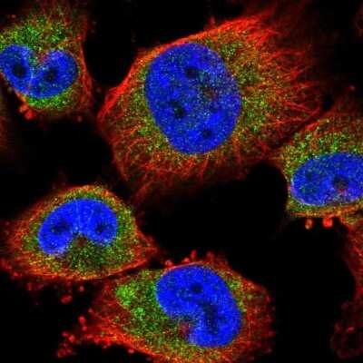 Immunocytochemistry/ Immunofluorescence: Membralin Antibody [NBP2-58243]