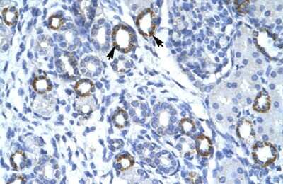 Immunohistochemistry: Membralin Antibody [NBP2-87796]