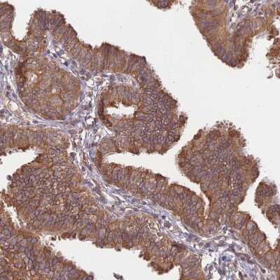 Immunohistochemistry-Paraffin: Membralin Antibody [NBP1-90088]