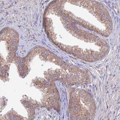 Immunohistochemistry-Paraffin: Membralin Antibody [NBP1-90088]