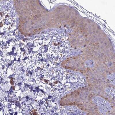 Immunohistochemistry-Paraffin: Membralin Antibody [NBP1-90088]