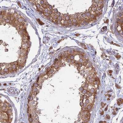 Immunohistochemistry-Paraffin: Membralin Antibody [NBP1-90088]