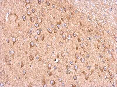 Immunohistochemistry-Paraffin: Membralin Antibody [NBP2-17276]