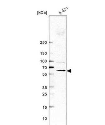 Western Blot: Membralin Antibody [NBP1-90088]