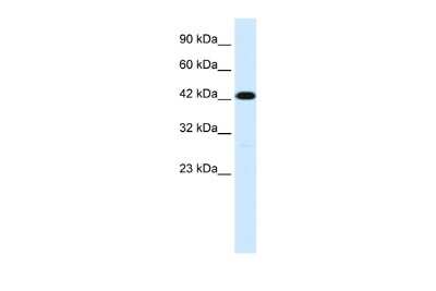 Western Blot: Membralin Antibody [NBP2-87796]