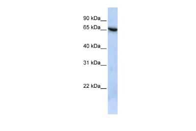 Western Blot: Membralin Antibody [NBP2-87797]