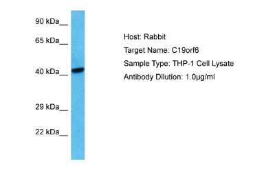 Western Blot: Membralin Antibody [NBP2-87798]