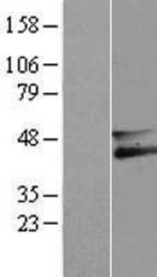 Western Blot: Membralin Overexpression Lysate [NBL1-08281]