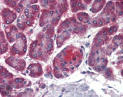 Immunohistochemistry: Membrin Antibody (4HAD6) [NBP2-89025]
