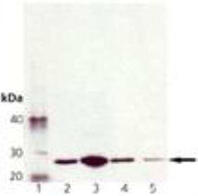 Western Blot: Membrin Antibody (4HAD6) [NBP2-89025]