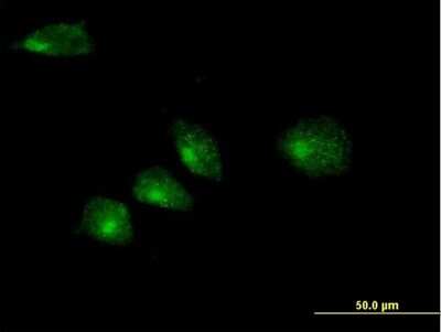 Immunocytochemistry/ Immunofluorescence: Membrin Antibody [H00009570-B01P]