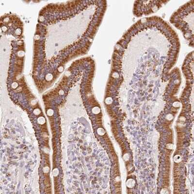 Immunohistochemistry-Paraffin: Membrin Antibody [NBP2-47379]