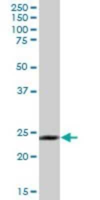 Western Blot: Membrin Antibody [H00009570-B01P]