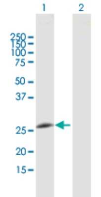 Western Blot: Membrin Antibody [H00009570-B01P]