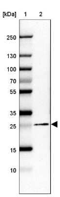 Western Blot: Membrin Antibody [NBP2-47379]