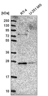 Western Blot: Membrin Antibody [NBP2-54985]