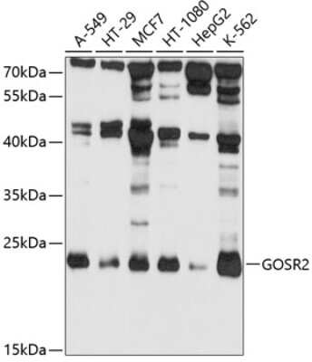 Western Blot: Membrin AntibodyBSA Free [NBP3-03314]