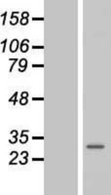 Western Blot: Membrin Overexpression Lysate [NBL1-11206]