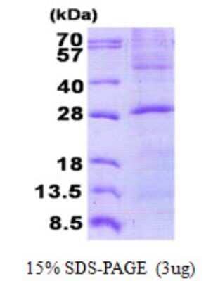 SDS-PAGE: Recombinant Human Membrin His Protein [NBP2-23085]