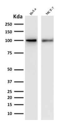 Western Blot: Mena Antibody (ENAH/1988)Azide and BSA Free [NBP2-79887]