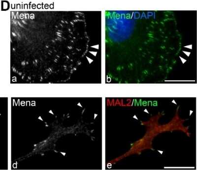 Immunocytochemistry/ Immunofluorescence: Mena Antibody [NBP1-87914]