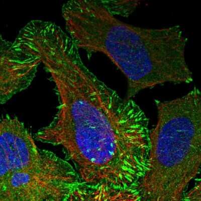 Immunocytochemistry/ Immunofluorescence: Mena Antibody [NBP1-87915]