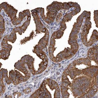 Immunohistochemistry-Paraffin: Mena Antibody [NBP1-87914]