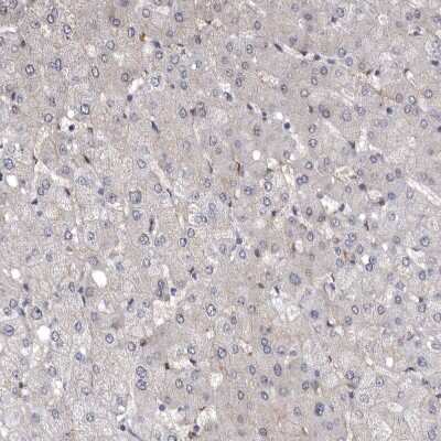 Immunohistochemistry-Paraffin: Mena Antibody [NBP1-87914]