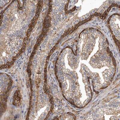 Immunohistochemistry-Paraffin: Mena Antibody [NBP1-87914]