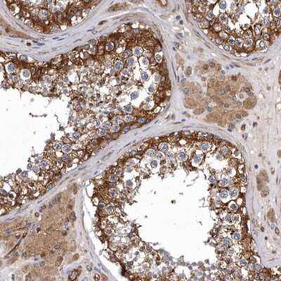Immunohistochemistry-Paraffin: Mena Antibody [NBP1-87914]