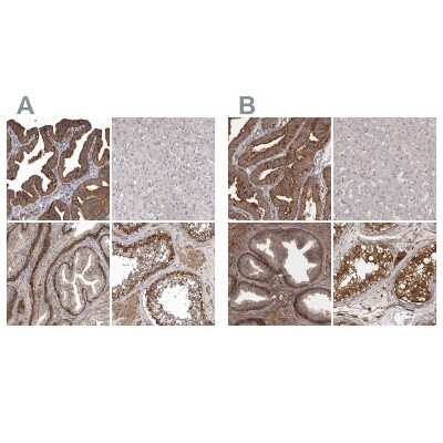 Immunohistochemistry-Paraffin: Mena Antibody [NBP1-87914]