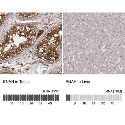 Immunohistochemistry-Paraffin: Mena Antibody [NBP1-87915]