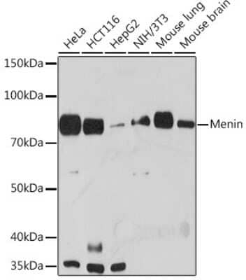 Western Blot: Menin Antibody (5M7L9) [NBP3-16180]