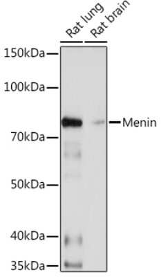 Western Blot: Menin Antibody (5M7L9) [NBP3-16180]