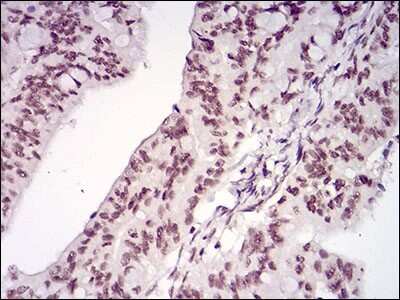 Immunohistochemistry-Paraffin: Menin Antibody (7D3E10) - BSA Free [NBP2-37251]
