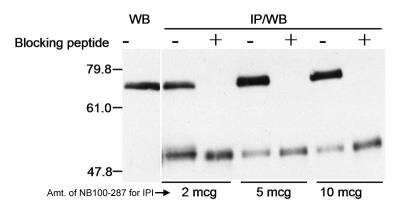 Western Blot: Menin Antibody [NB100-287]