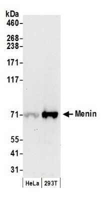 Western Blot: Menin Antibody [NB100-287]