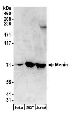 Western Blot: Menin Antibody [NB100-399]