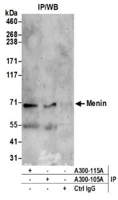 Western Blot: Menin Antibody [NB100-399]