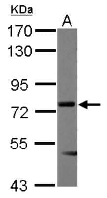 Western Blot: Menin Antibody [NBP2-17277]