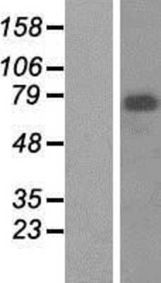 Western Blot: Menin Overexpression Lysate [NBP2-05738]