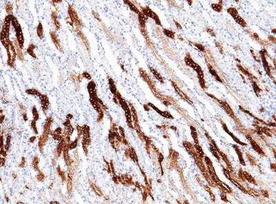 Immunohistochemistry-Paraffin: Meprin alpha Subunit/MEP1A Antibody (001) [NBP2-90383]