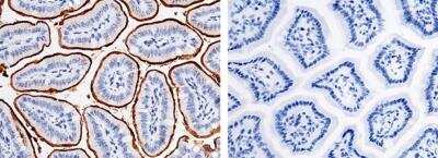 Immunohistochemistry-Paraffin: Meprin alpha Subunit/MEP1A Antibody (001) [NBP2-90383]