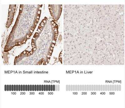 Immunohistochemistry-Paraffin: Meprin alpha Subunit/MEP1A Antibody [NBP1-87238]