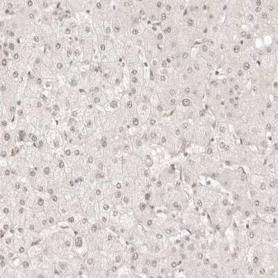 Immunohistochemistry-Paraffin: Meprin alpha Subunit/MEP1A Antibody [NBP1-87238]