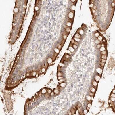 Immunohistochemistry-Paraffin: Meprin alpha Subunit/MEP1A Antibody [NBP1-87238]