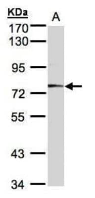 Western Blot: Meprin alpha Subunit/MEP1A Antibody [NBP1-32595]