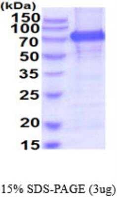 SDS-PAGE: Recombinant Human Meprin alpha Subunit/MEP1A His Protein [NBP2-52626]