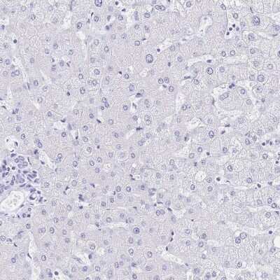 Immunohistochemistry-Paraffin: Meprin beta Subunit/MEP1B Antibody [NBP2-37865]