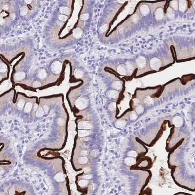 Immunohistochemistry-Paraffin: Meprin beta Subunit/MEP1B Antibody [NBP2-37865]